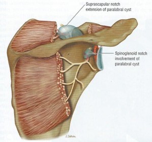 Test Your X Ray Iq Deep Posterior Shoulder Pain Airrosti