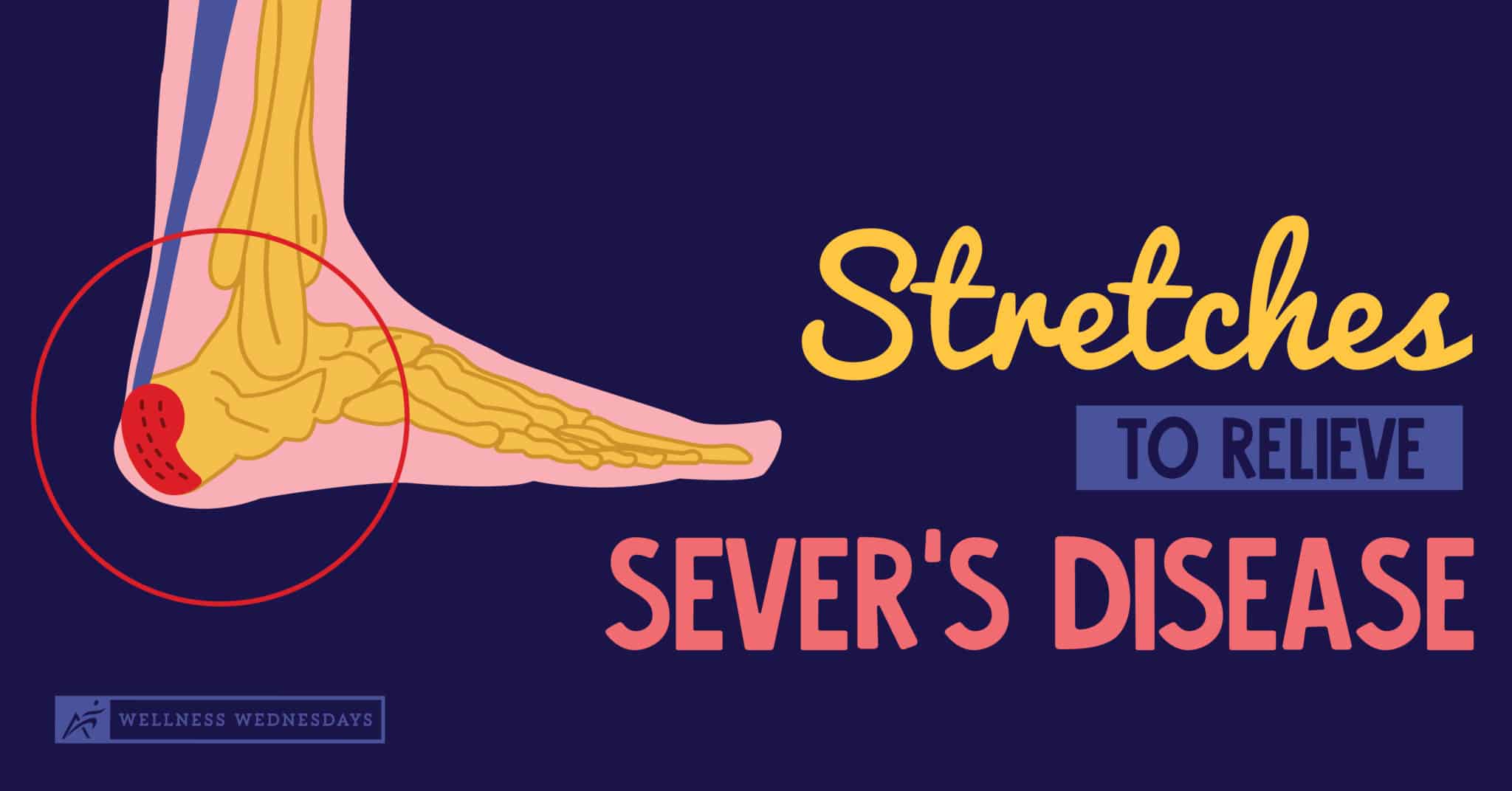 Stretches to Help Relieve Sever's Disease - AIRROSTI