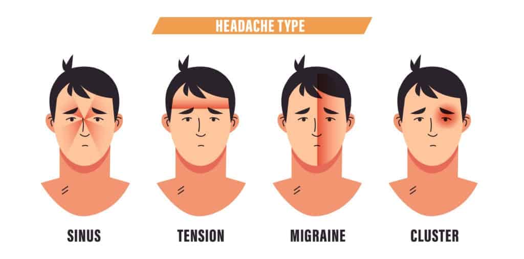 Tension Headaches Symptoms Causes Diagnosis Treatment Airrosti