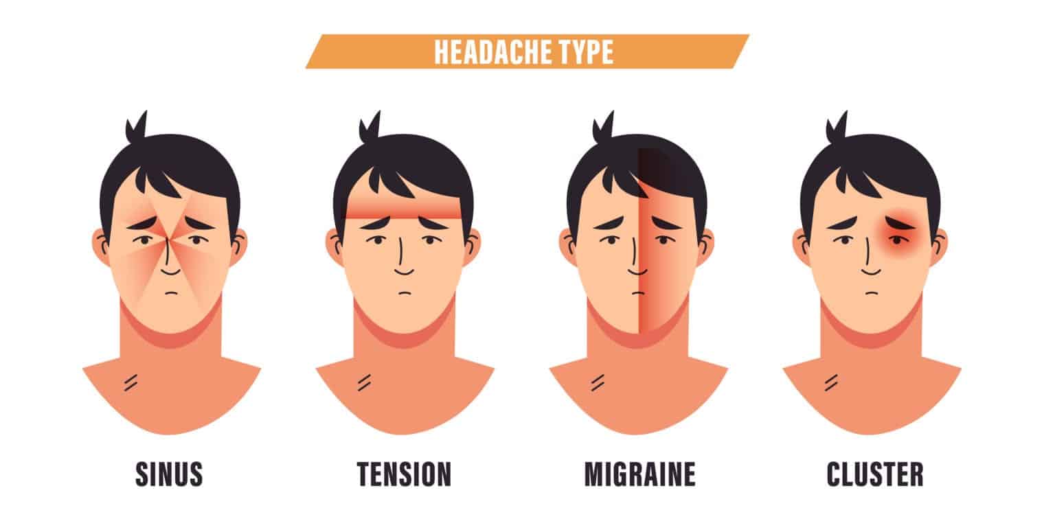 tension-headaches-symptoms-causes-diagnosis-treatment-airrosti