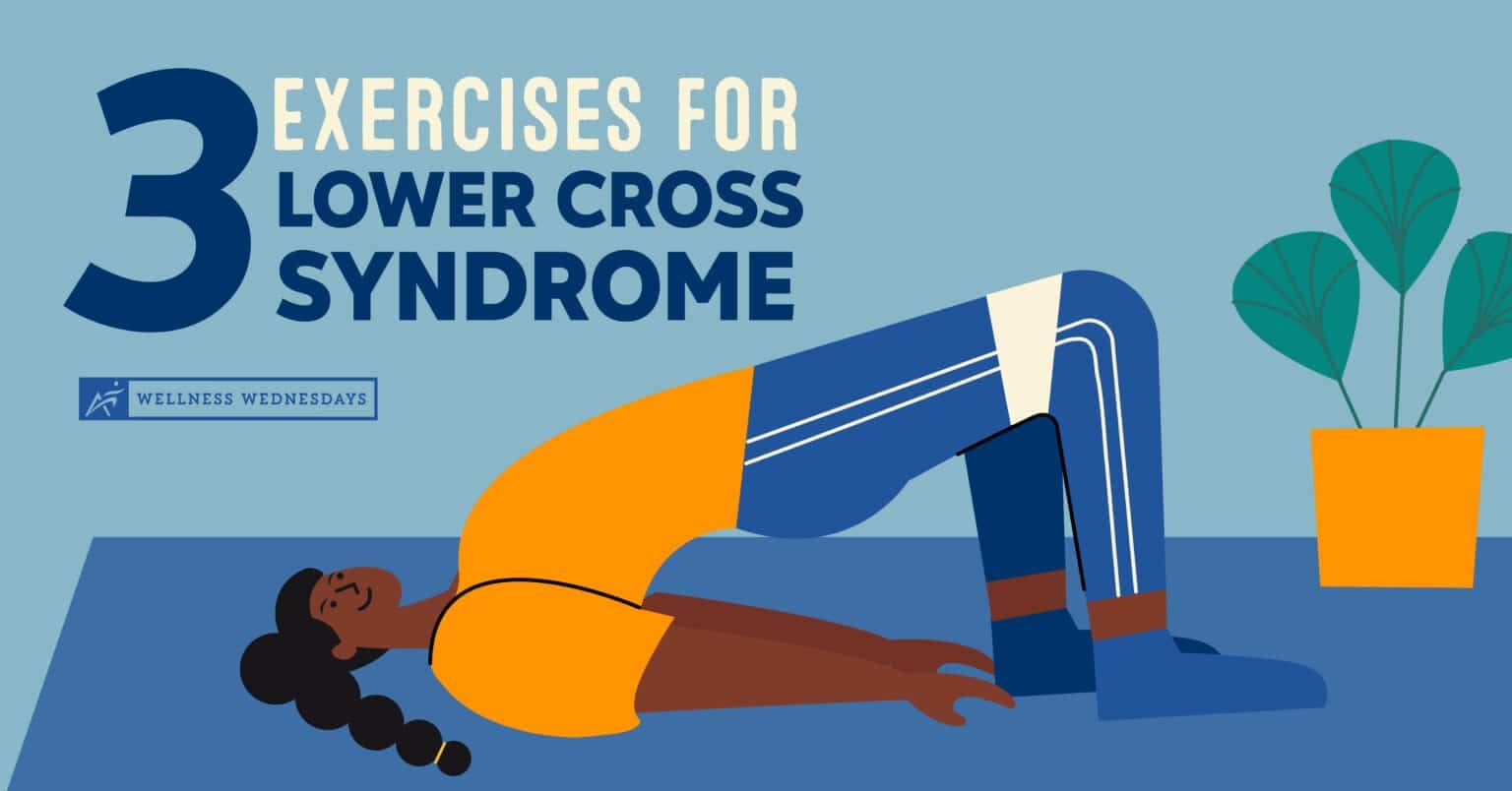 3 Exercises for Lower Cross Syndrome | Low Back Pain | Airrosti